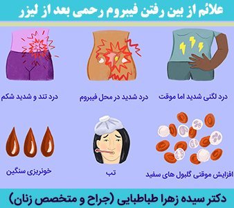  هزینه عمل فیبروم رحم با لیزر