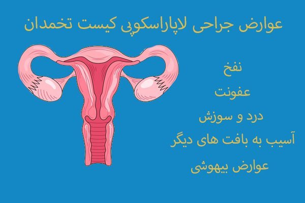  هزینه عمل فیبروم رحم با لیزر