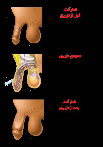  اندازه نرمال آلت تناسلی مرد و ارتباط آن با لذت جنسی