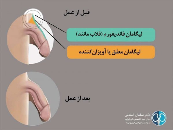  اندازه نرمال آلت تناسلی مرد و ارتباط آن با لذت جنسی