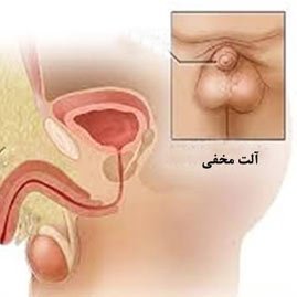  علت داخل رفتن کلاهک تناسلی مردان