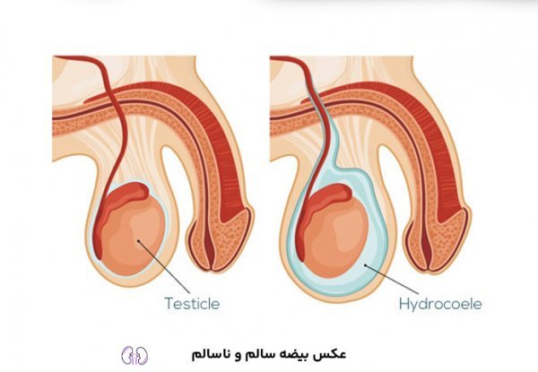 عکس بیضه سالم و ناسالم