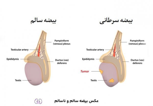  عکس بیضه سالم و ناسالم