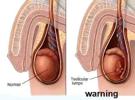  عکس بیضه سالم و ناسالم