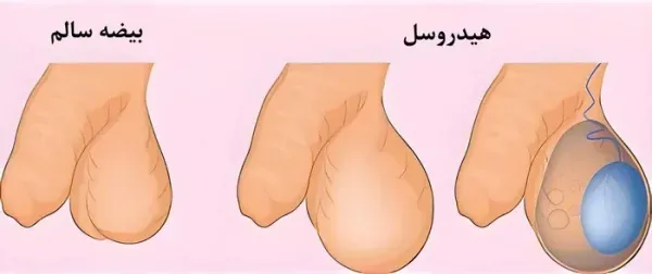  کدام بیضه اسپرم ساز است؟