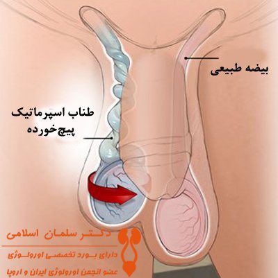  کدام بیضه اسپرم ساز است؟