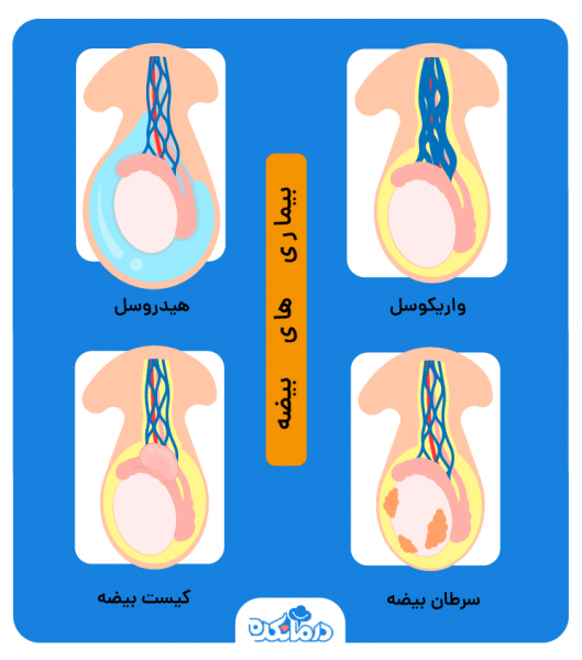  کدام بیضه اسپرم ساز است؟