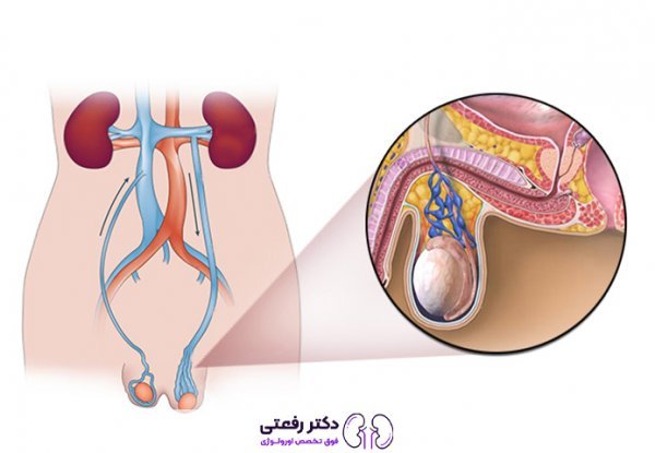  چه چیزی برای درد بیضه خوب است؟