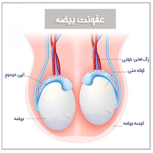 چه قرصی برای عفونت بیضه خوب است/ درمان اپیدیدیمیت