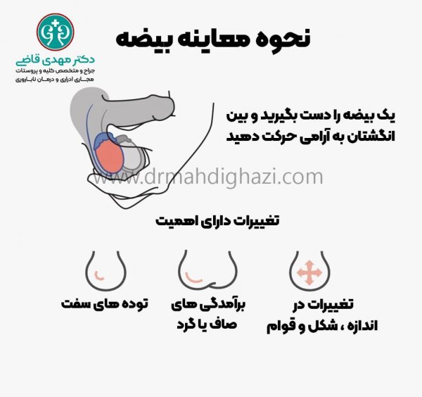  چه قرصی برای عفونت بیضه خوب است/ درمان اپیدیدیمیت