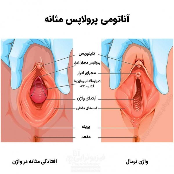  رابطه جنسی سکس زیاد چه تاثیری بر رحم و تخمدان دارد؟