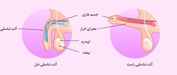  علت درد بعد از ارضا شدن در مردان