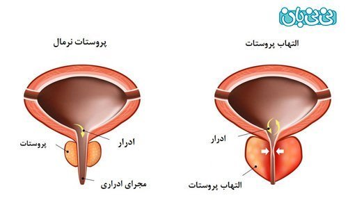  علت درد بعد از ارضا شدن در مردان