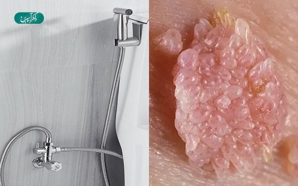  آیا تبخال تناسلی از طریق استخر منتقل می شود/ انتقال تبخال تناسلی از زن به مرد