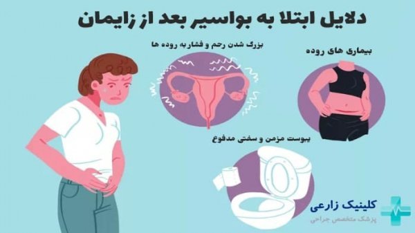  عکس بواسیر بعد از زایمان طبیعی