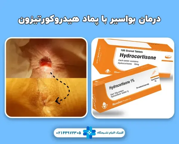  درمان فوری درد بواسیر در خانه