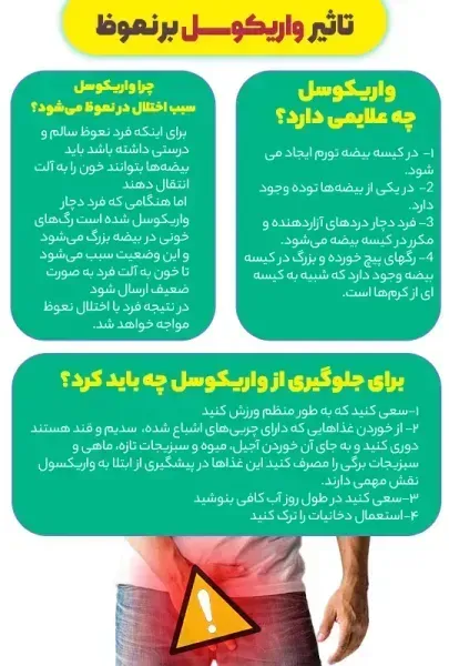  عوارض واریکوسل بیضه چپ / بیضه راست