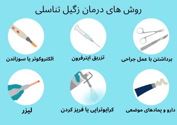  آیا بعد از لیزر + فریز زگیل تناسلی میتوان رابطه جنسی داشت؟