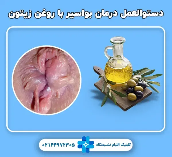  چه داروی گیاهی برای بواسیر خوب است؟