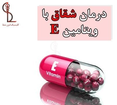  بهترین پماد برای درمان شقاق در بارداری