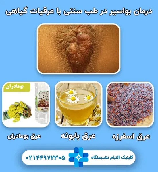 درمان گیاهی زخم مقعدی +معجزه درمان شقاق مقعد