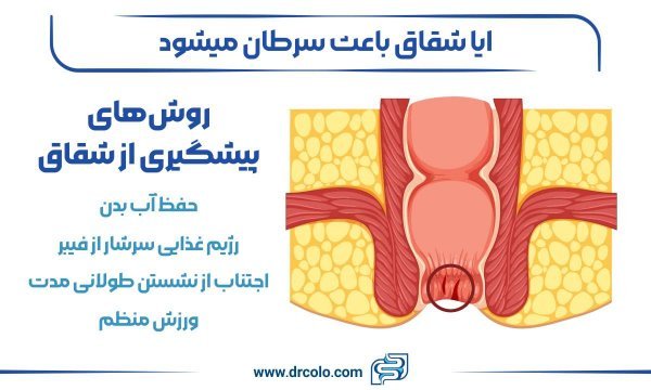  درمان گیاهی زخم مقعدی +معجزه درمان شقاق مقعد