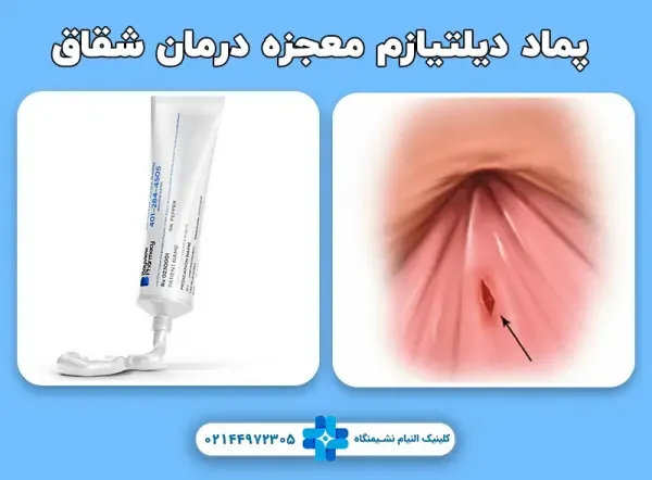  درمان گیاهی زخم مقعدی +معجزه درمان شقاق مقعد