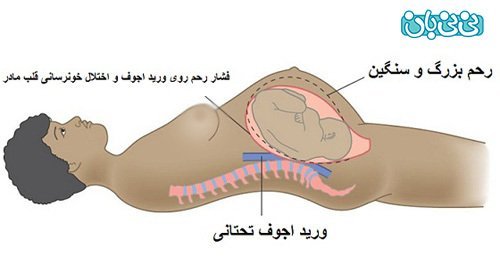  عکس درست خوابیدن در بارداری