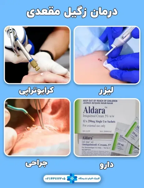  کرایو یا کرایوتراپی زگیل تناسلی چگونه است؟