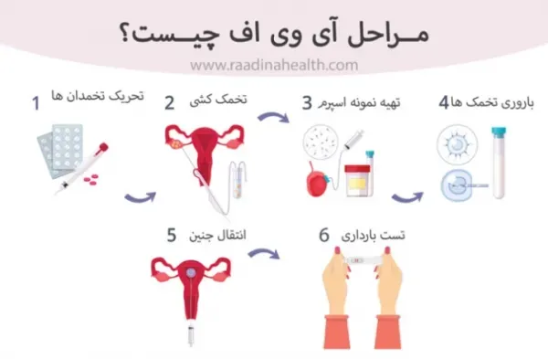  ای وی اف IVF یعنی چه+لقاح مصنوعی چگونه است؟