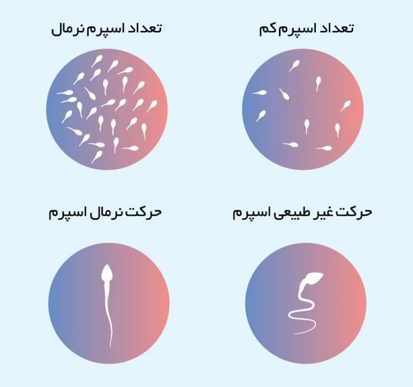  قیمت فروش اسپرم+شرایط اهدای اسپرم