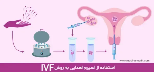  قیمت فروش اسپرم+شرایط اهدای اسپرم