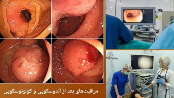  چه زمانی باید کولونوسکوپی کرد+فیلم عمل کولونوسکوپی