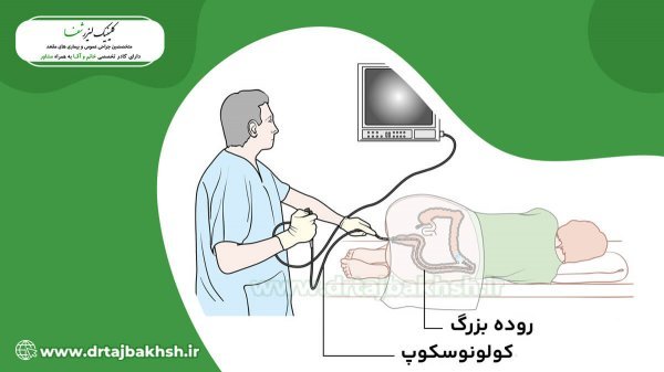 کولونوسکوپی روده بزرگ چیست؟