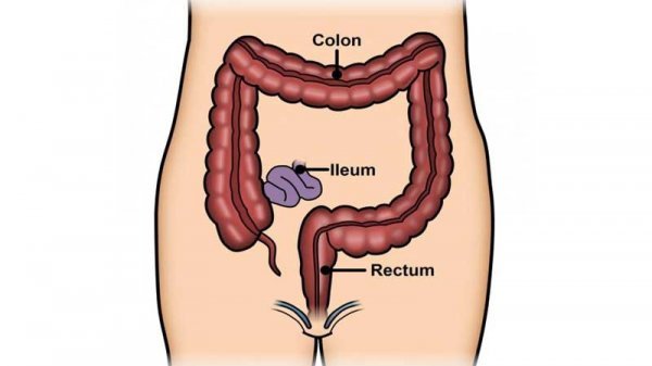  یک داروی جدید برای درمان بیماری کولیت روده تایید شد!