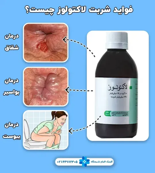  چه قرصی برای کولیت روده مناسب است؟