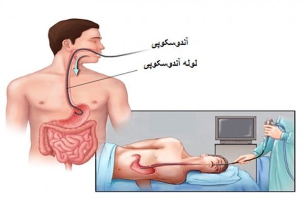 آیا آندوسکوپی زیاد ضرر دارد؟