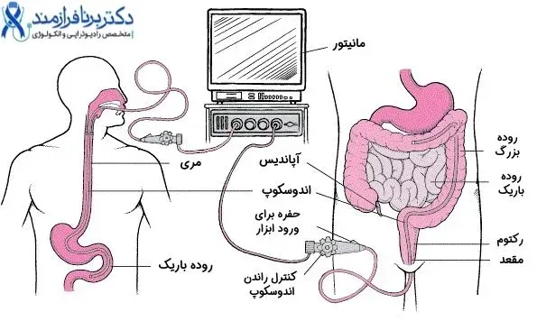 هزینه اندوسکوپی در مطب خصوصی+هزینه آندوسکوپی با بیمه تأمین اجتماعی۱۴۰۴