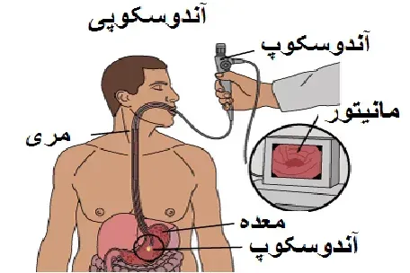  هزینه اندوسکوپی در مطب خصوصی+هزینه آندوسکوپی با بیمه تأمین اجتماعی۱۴۰۴