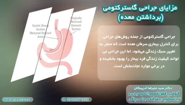  کسانی که سرطان معده را شکست دادند