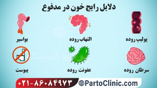  دیدن خون در مدفوع نشانه چیست+عکس خون در مدفوع