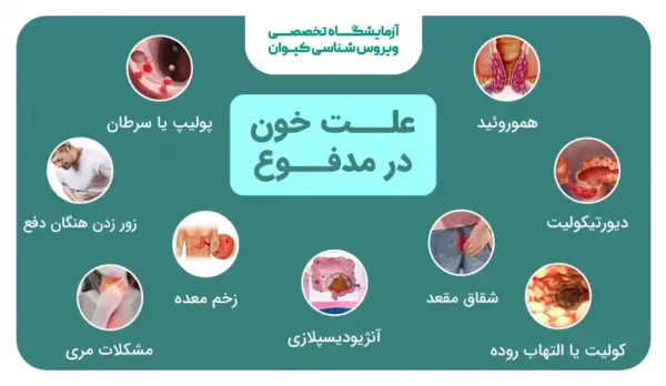  دیدن خون در مدفوع نشانه چیست+عکس خون در مدفوع