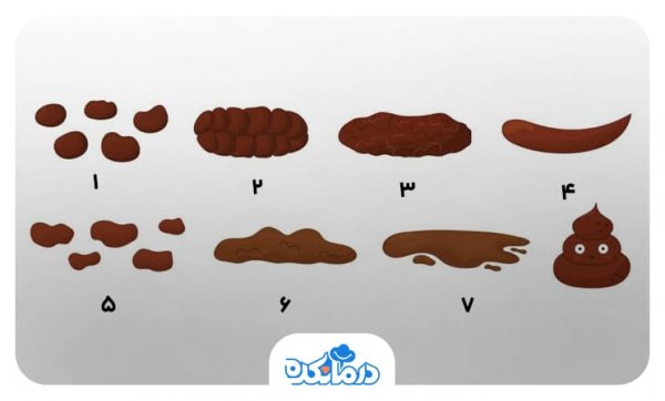 سندروم روده تحریک پذیر و خون در مدفوع