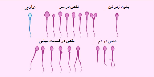  اسپرم آبکی نشانه چیست؟