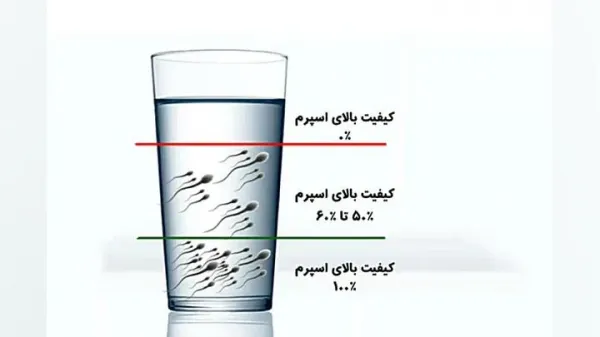  اسپرم آبکی نشانه چیست؟