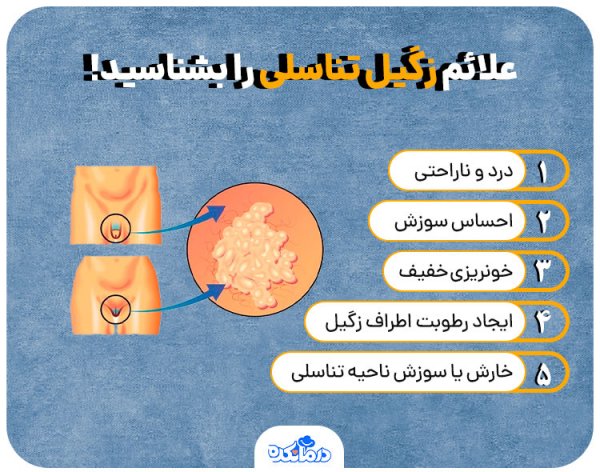  آیا زگیل تناسلی در مردان واگیردار است؟