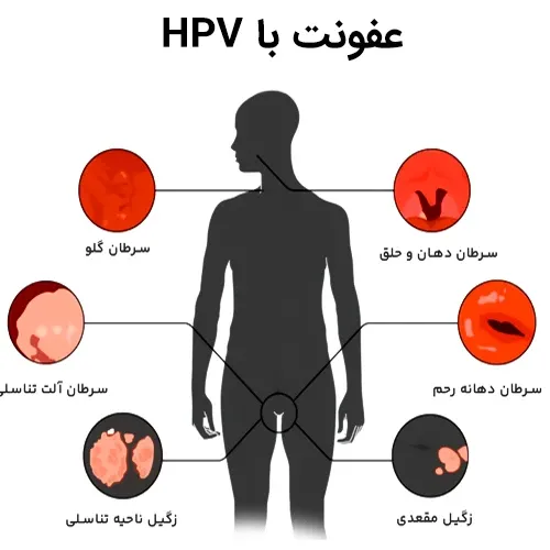  عکس زگیل دهانی خفیف
