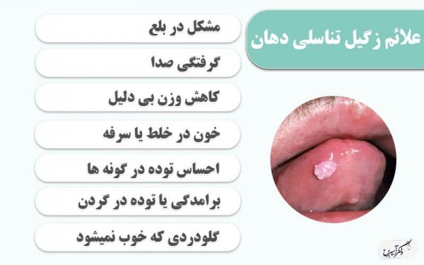  بهترین قرص برای زگیل دهانی