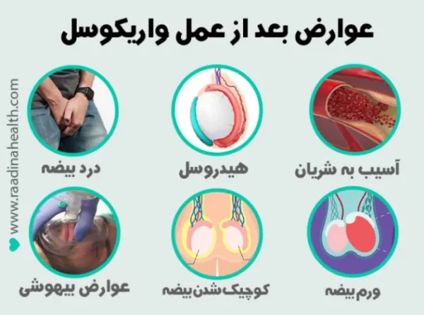  آیا بعد از عمل واریکوسل اسپرم قوی میشود؟