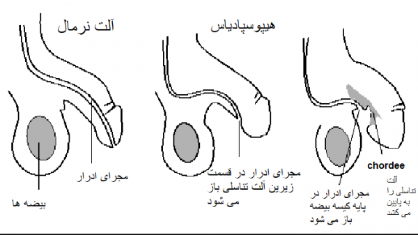  سایز استاندارد آلت مردان